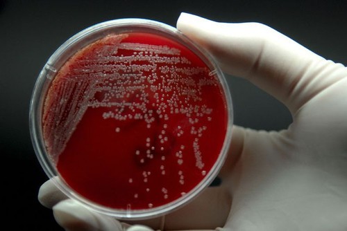 ���ಡ����40%  �յ���Ⱦ�ж���� 