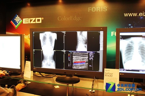 艺卓新款医疗级显示器详解_Eizo液晶显示器_液晶显示器新闻-中关村在线